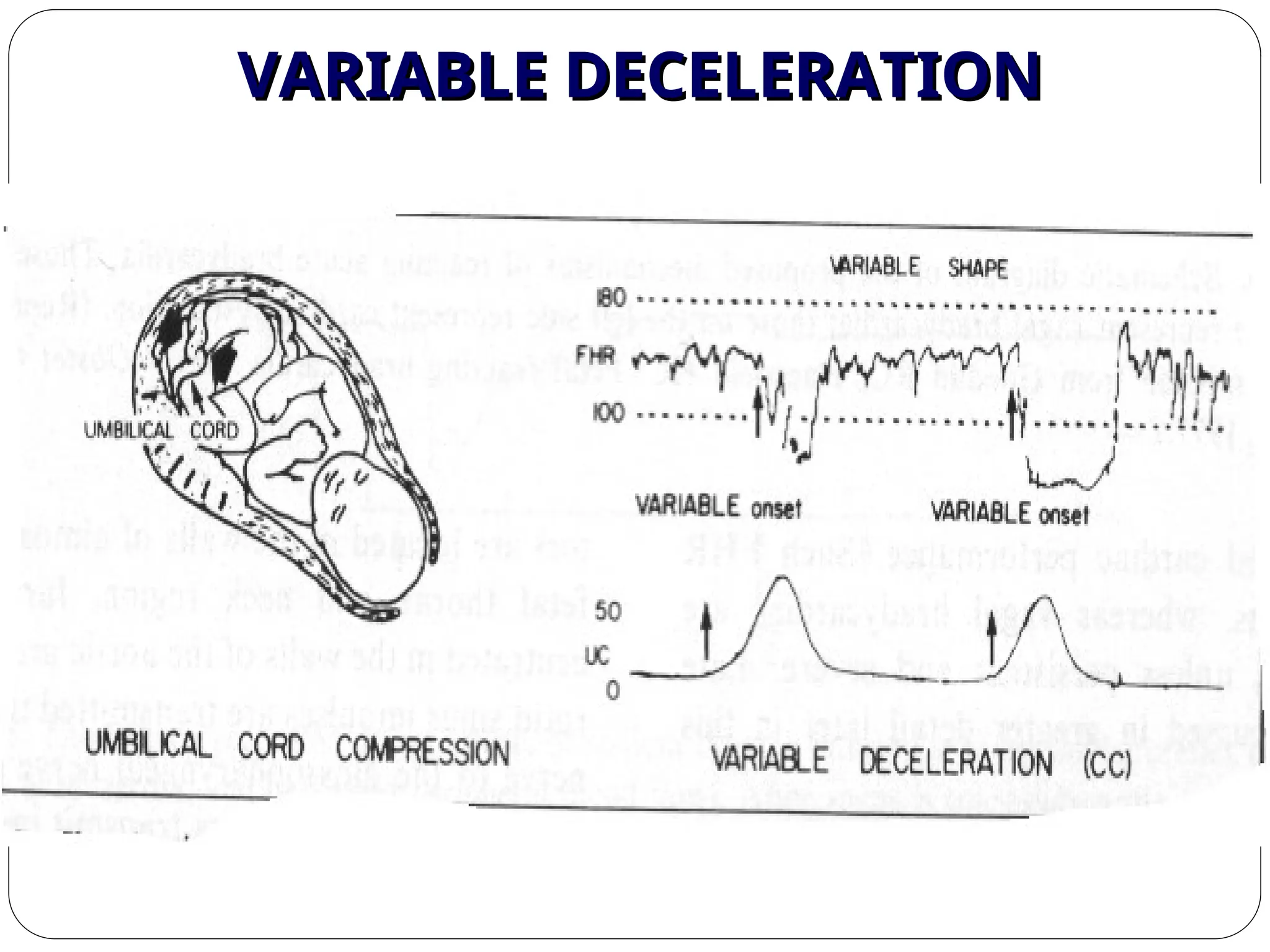 VARIABLE DECELERATION
VARIABLE DECELERATION
 