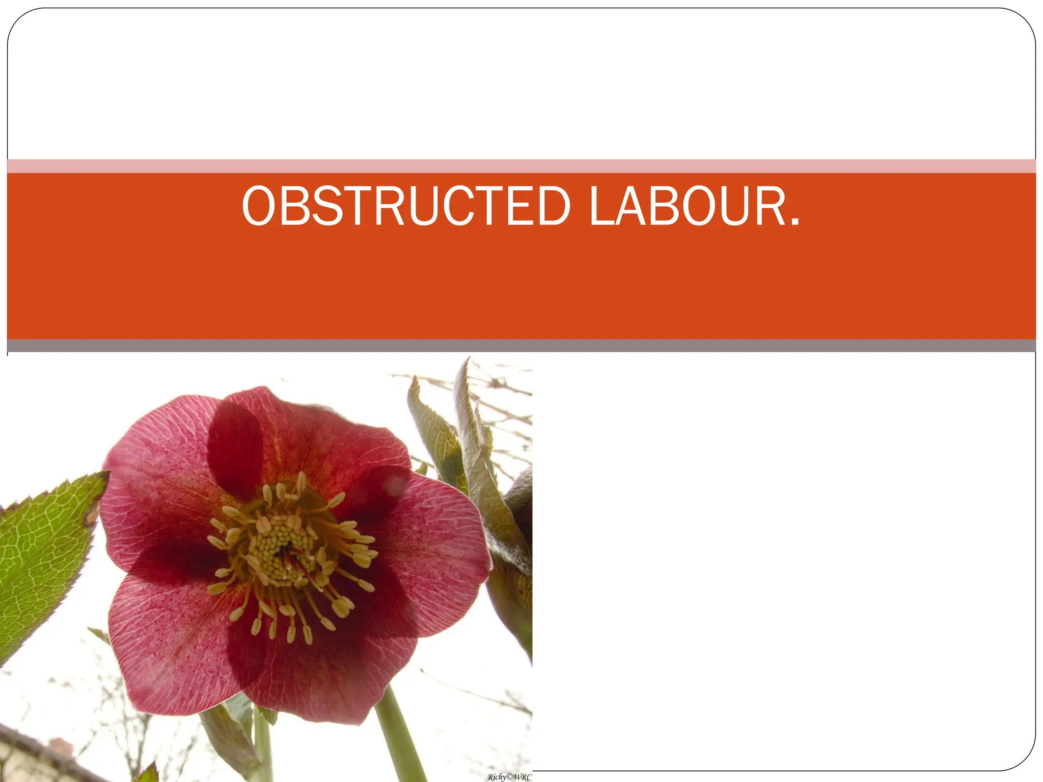 OBSTRUCTED LABOUR.
 