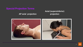 Fundamental Principles and Terminology in Radiographic Positioning and ...