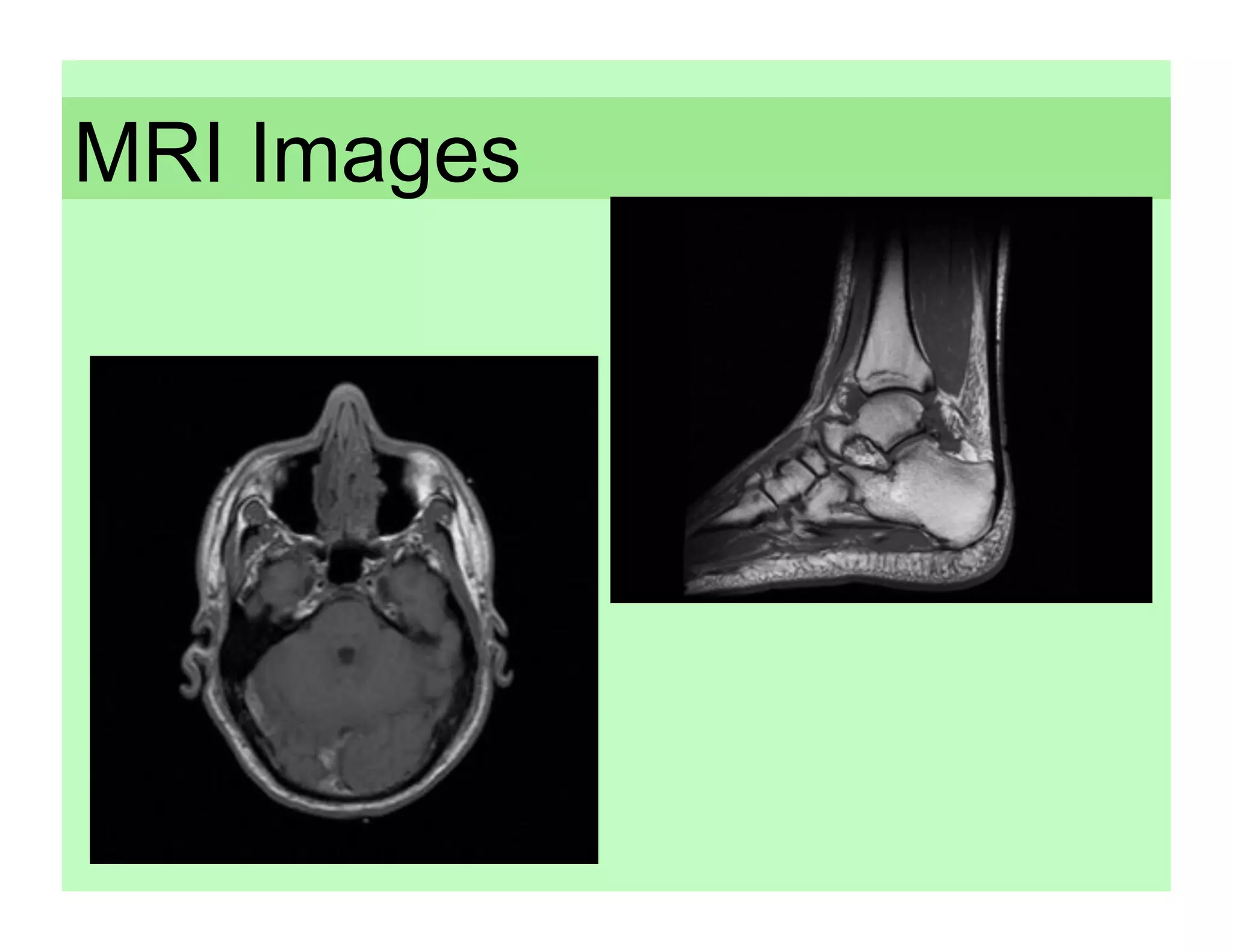 MRI Images
 
