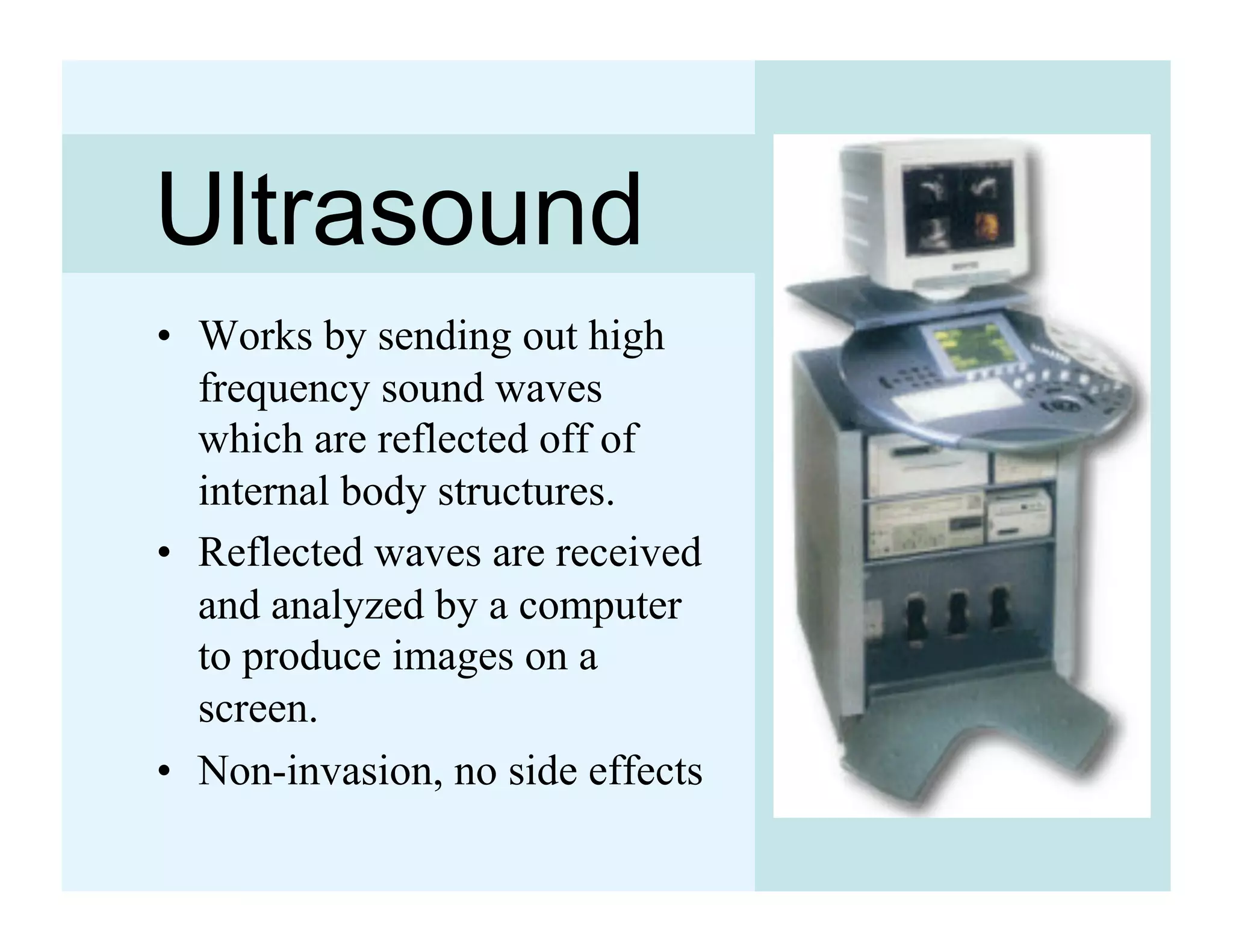 Ultrasound
•  Works by sending out high
   frequency sound waves
   which are reflected off of
   internal body structures.
•  Reflected waves are received
   and analyzed by a computer
   to produce images on a
   screen.
•  Non-invasion, no side effects
 
