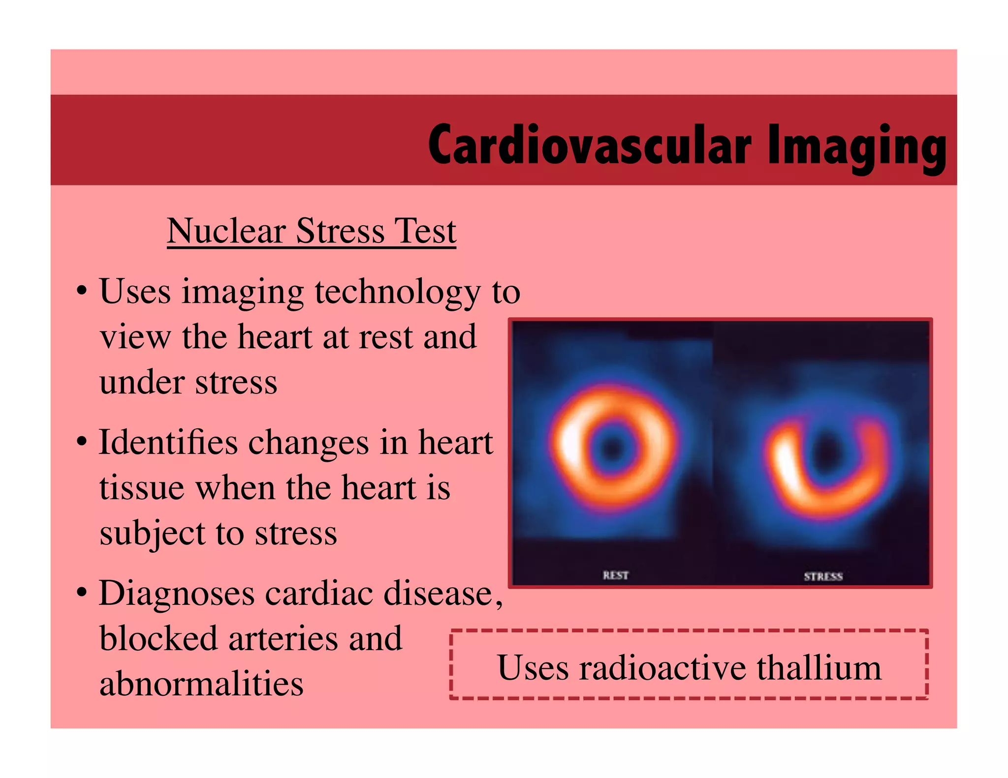 Cardiovascular Imaging
      Nuclear Stress Test
                        	

•  Uses imaging technology to
   view the heart at rest and
   under stress	

•  Identiﬁes changes in heart
   tissue when the heart is
   subject to stress	

•  Diagnoses cardiac disease,
   blocked arteries and
   abnormalities	

         Uses radioactive thallium	

 