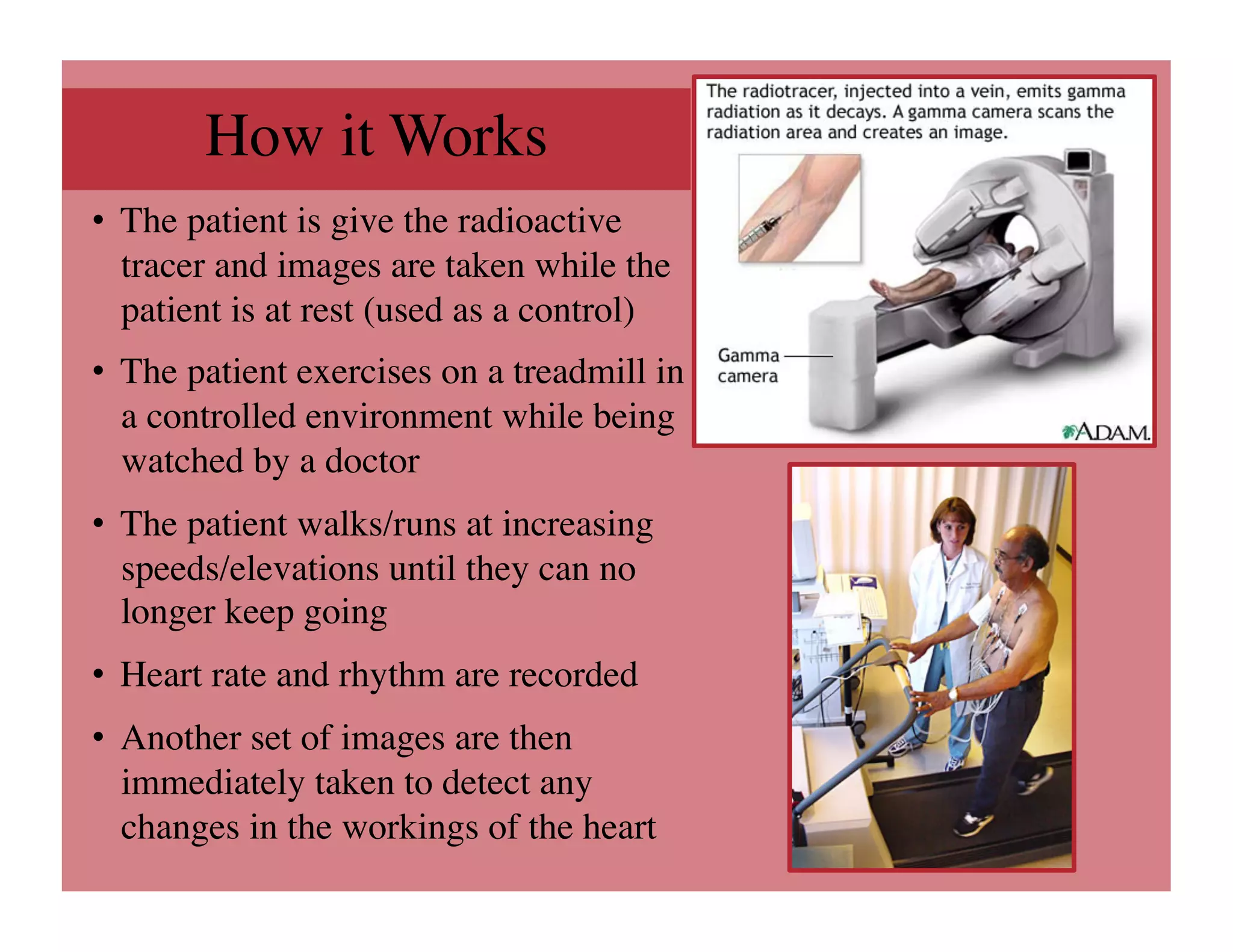 How it Works
                   	

•  The patient is give the radioactive
   tracer and images are taken while the
   patient is at rest (used as a control)	

•  The patient exercises on a treadmill in
   a controlled environment while being
   watched by a doctor	

•  The patient walks/runs at increasing
   speeds/elevations until they can no
   longer keep going	

•  Heart rate and rhythm are recorded	

•  Another set of images are then
   immediately taken to detect any
   changes in the workings of the heart	

 