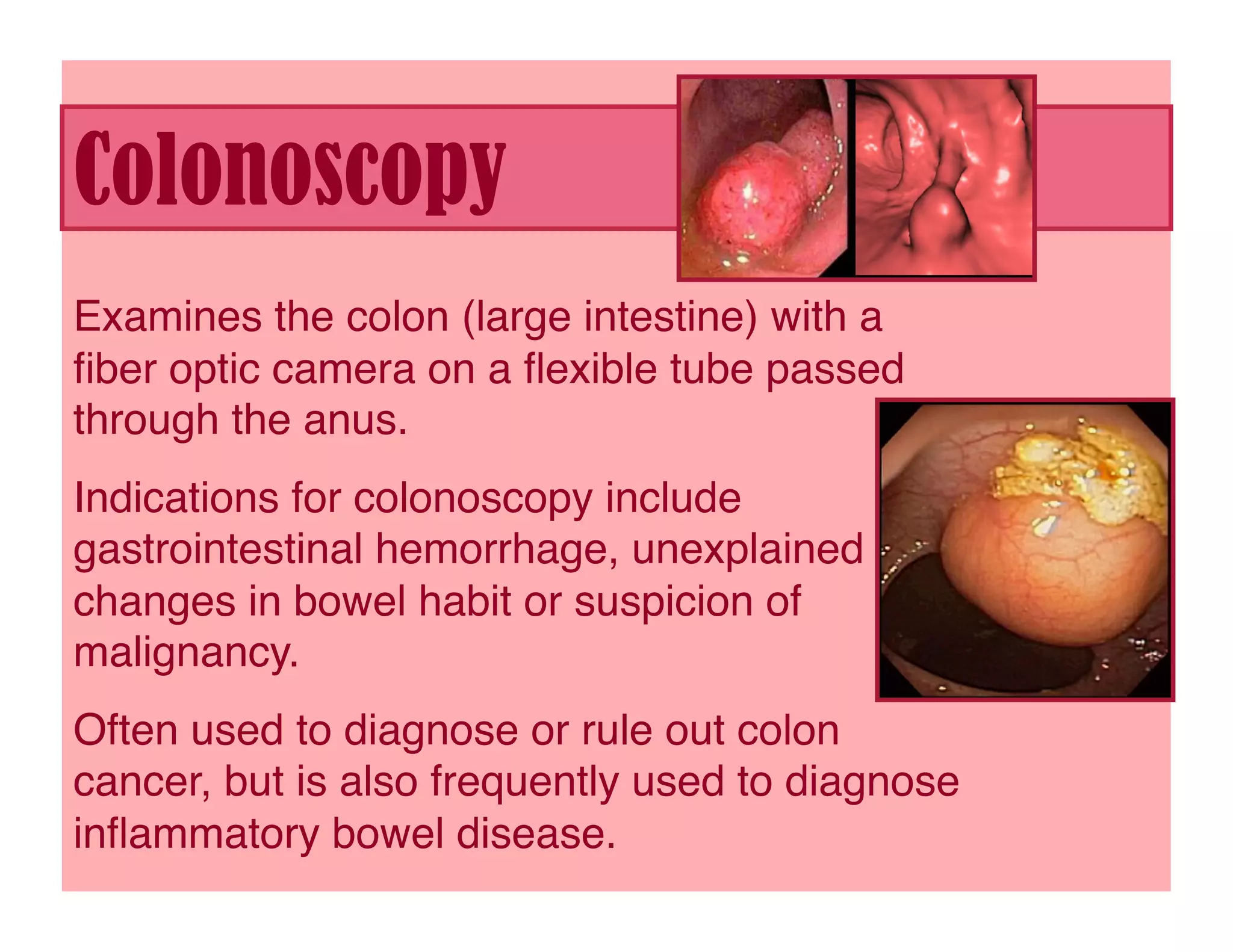 Colonoscopy
Examines the colon (large intestine) with a
ﬁber optic camera on a ﬂexible tube passed
through the anus.
Indications for colonoscopy include
gastrointestinal hemorrhage, unexplained
changes in bowel habit or suspicion of
malignancy. 
Often used to diagnose or rule out colon
cancer, but is also frequently used to diagnose
inﬂammatory bowel disease. 
 