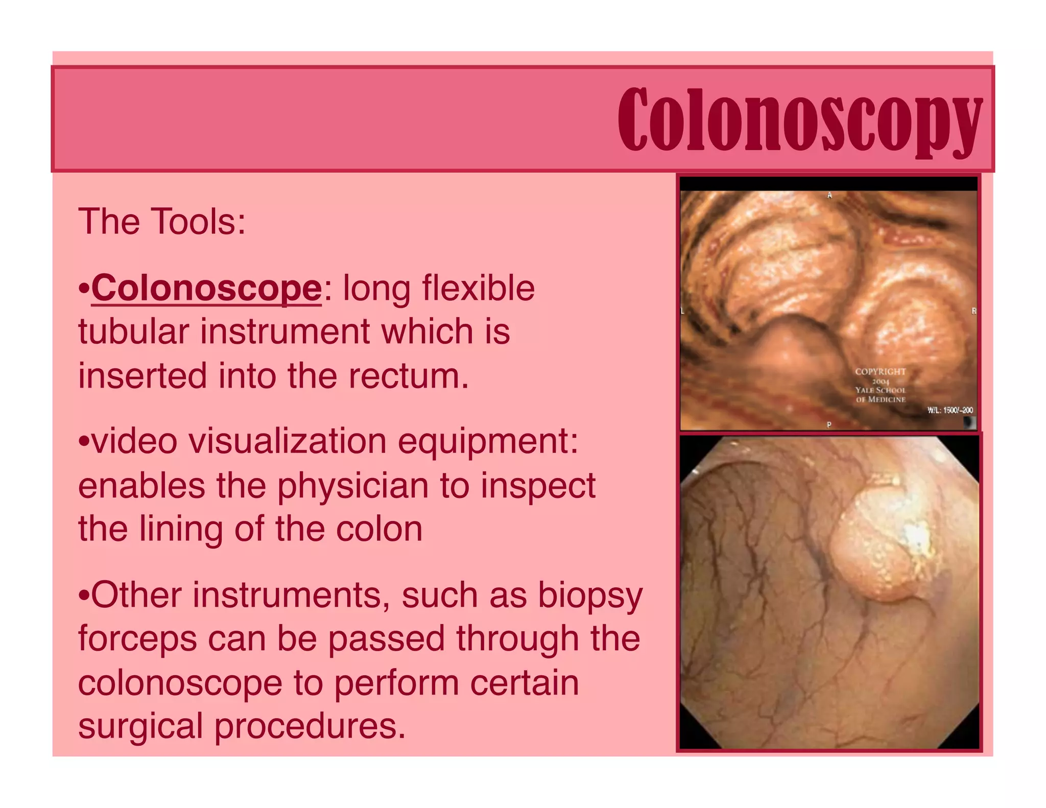 Colonoscopy
The Tools:
• Colonoscope: long ﬂexible
tubular instrument which is
inserted into the rectum. 
• video visualization equipment:
enables the physician to inspect
the lining of the colon 
• Other instruments, such as biopsy
forceps can be passed through the
colonoscope to perform certain
surgical procedures.
 