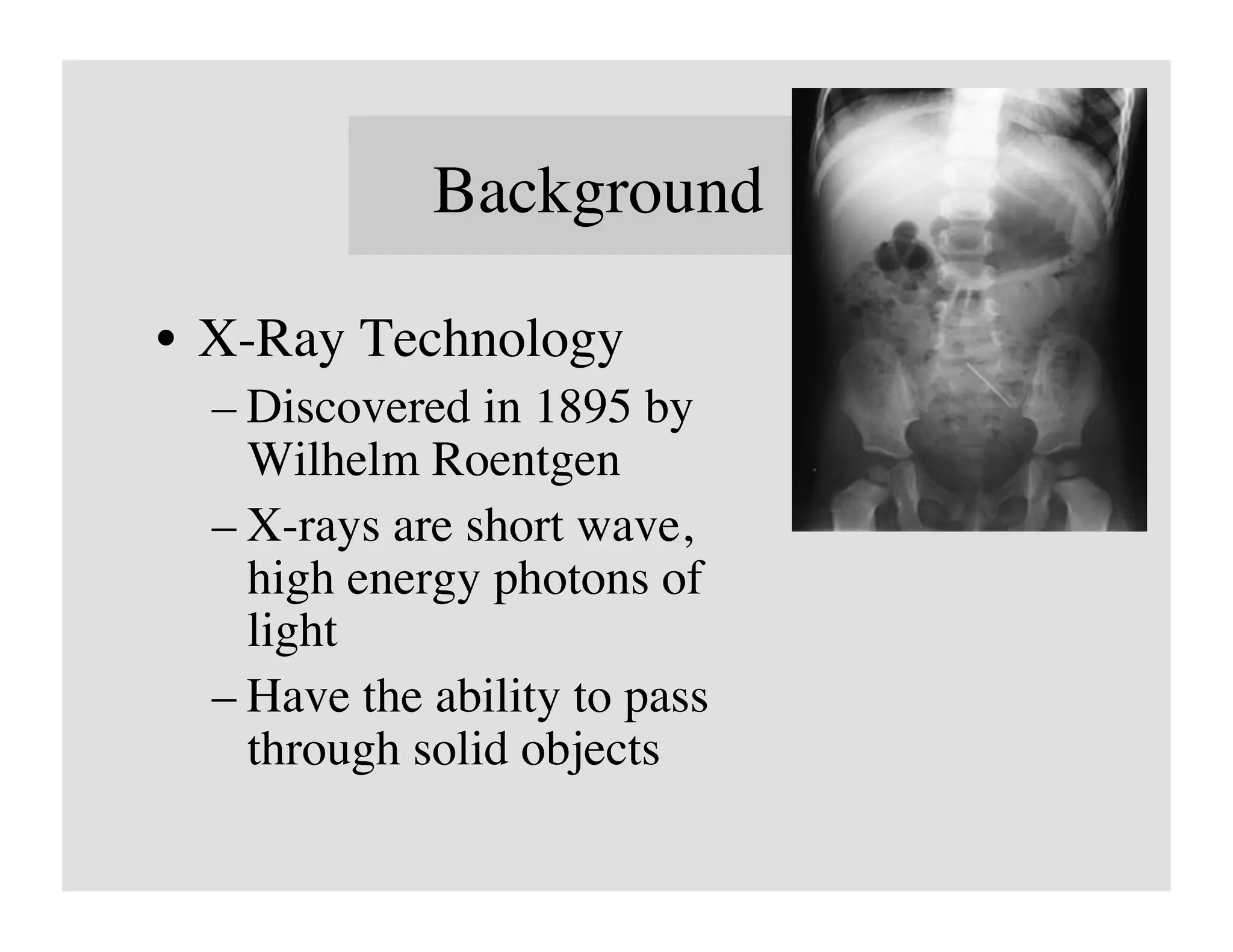 Background	


•  X-Ray Technology	

  – Discovered in 1895 by
    Wilhelm Roentgen	

  – X-rays are short wave,
    high energy photons of
    light	

  – Have the ability to pass
    through solid objects 	

 