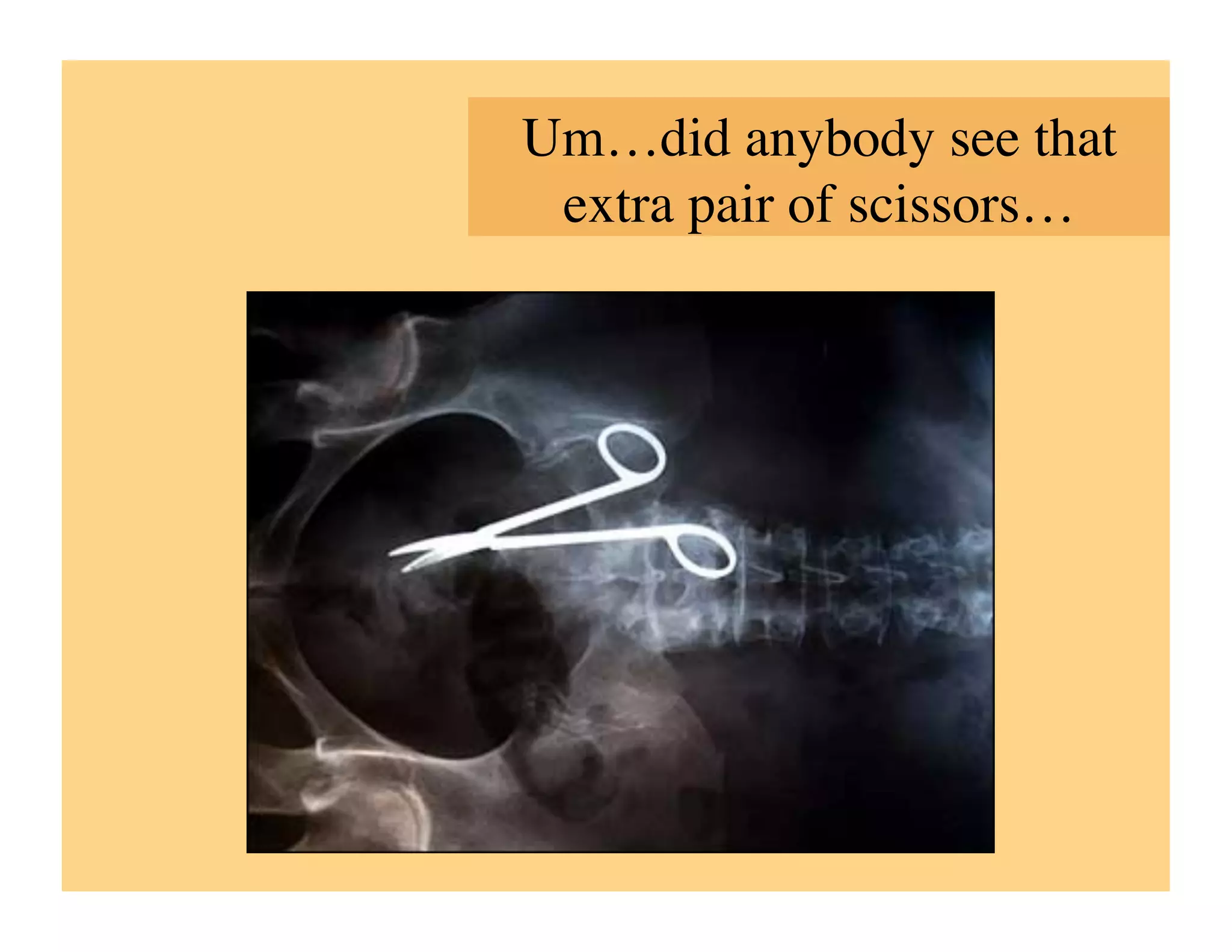 Um…did anybody see that
 extra pair of scissors…	

 