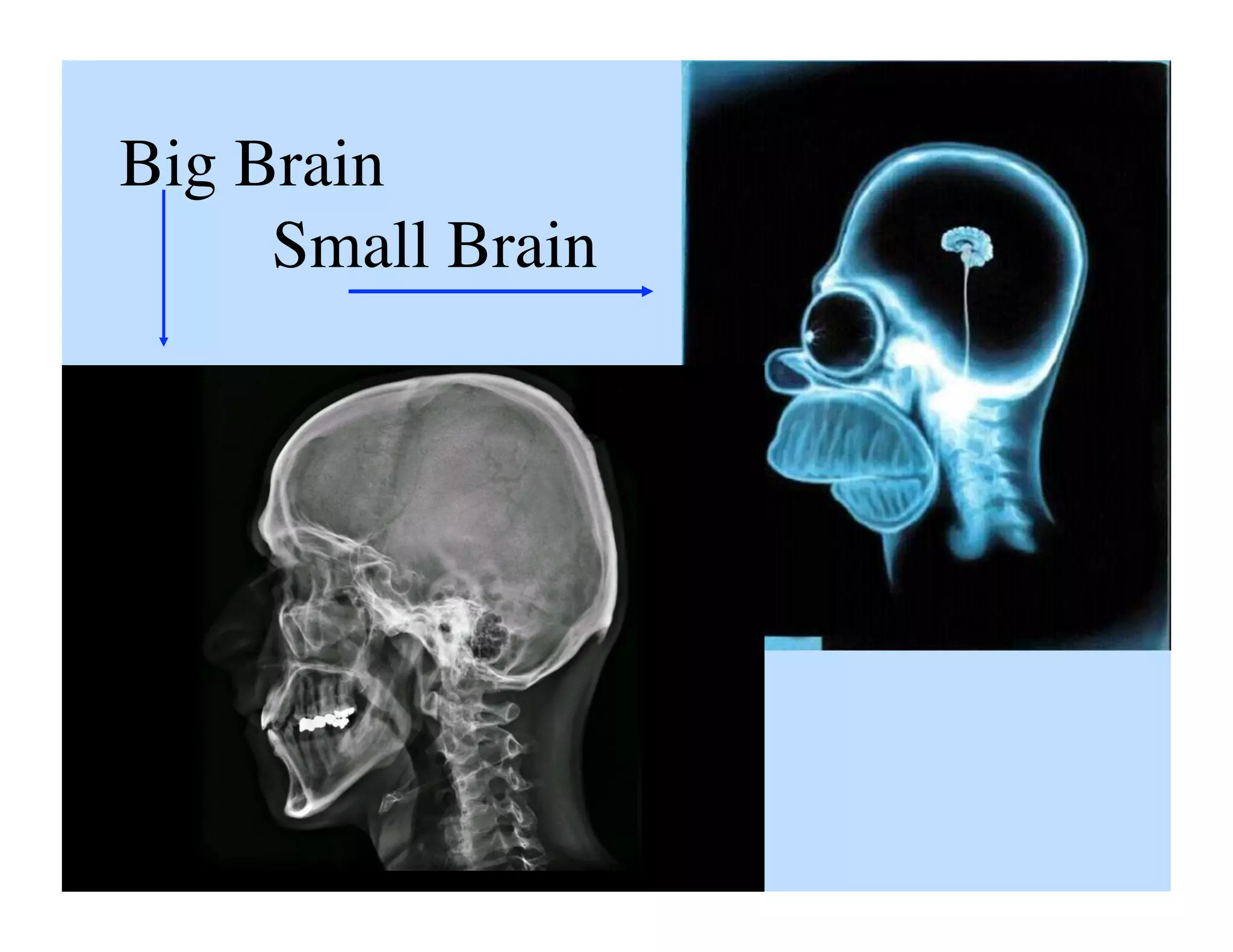 Big Brain
     Small Brain	

 