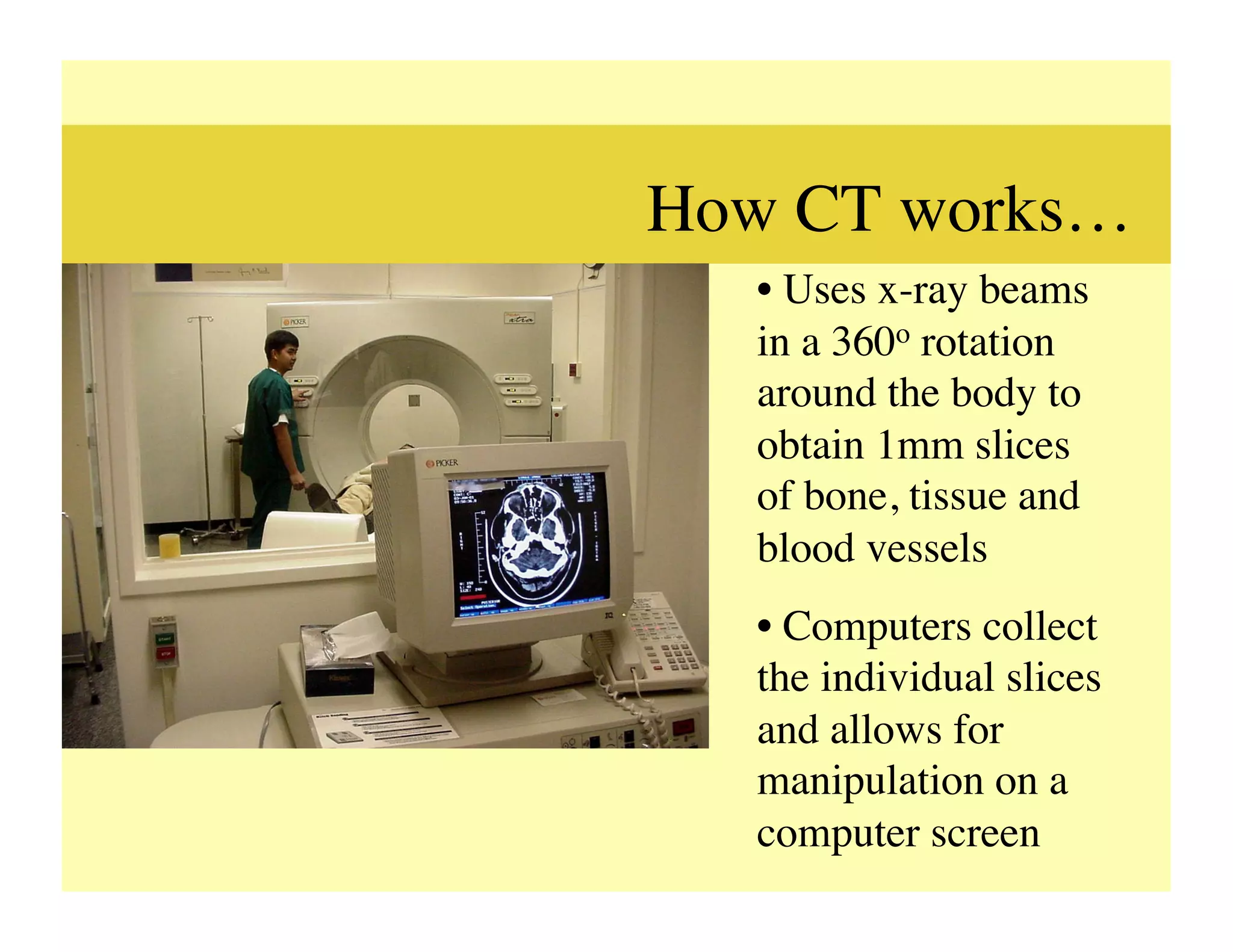 How CT works…	

   •  Uses x-ray beams
   in a 360o rotation
   around the body to
   obtain 1mm slices
   of bone, tissue and
   blood vessels	

   •  Computers collect
   the individual slices
   and allows for
   manipulation on a
   computer screen	

 