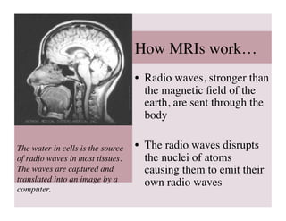 How MRIs work…	

                                   •  Radio waves, stronger than
                                      the magnetic ﬁeld of the
                                      earth, are sent through the
                                      body	


The water in cells is the source   •  The radio waves disrupts
of radio waves in most tissues.       the nuclei of atoms
The waves are captured and            causing them to emit their
translated into an image by a         own radio waves	

computer.	

 