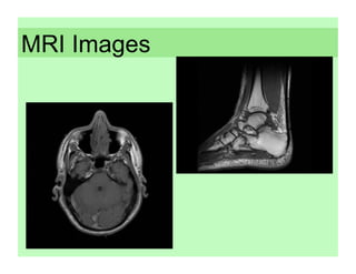 MRI Images
 