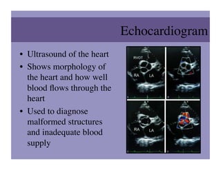 Echocardiogram 	

•  Ultrasound of the heart	

•  Shows morphology of
   the heart and how well
   blood ﬂows through the
   heart	

•  Used to diagnose
   malformed structures
   and inadequate blood
   supply	

 