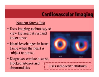 Cardiovascular Imaging
      Nuclear Stress Test
                        	

•  Uses imaging technology to
   view the heart at rest and
   under stress	

•  Identiﬁes changes in heart
   tissue when the heart is
   subject to stress	

•  Diagnoses cardiac disease,
   blocked arteries and
   abnormalities	

         Uses radioactive thallium	

 