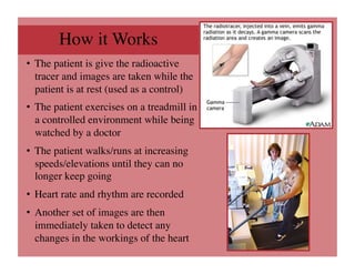 How it Works
                   	

•  The patient is give the radioactive
   tracer and images are taken while the
   patient is at rest (used as a control)	

•  The patient exercises on a treadmill in
   a controlled environment while being
   watched by a doctor	

•  The patient walks/runs at increasing
   speeds/elevations until they can no
   longer keep going	

•  Heart rate and rhythm are recorded	

•  Another set of images are then
   immediately taken to detect any
   changes in the workings of the heart	

 