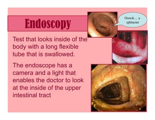 Ooooh… a

    Endoscopy                    sphincter
                                         	





Test that looks inside of the
body with a long flexible
tube that is swallowed.
The endoscope has a
camera and a light that
enables the doctor to look
at the inside of the upper
intestinal tract
 