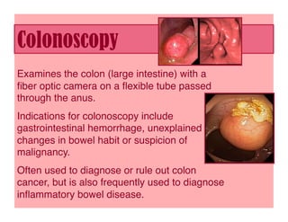 Colonoscopy
Examines the colon (large intestine) with a
ﬁber optic camera on a ﬂexible tube passed
through the anus.
Indications for colonoscopy include
gastrointestinal hemorrhage, unexplained
changes in bowel habit or suspicion of
malignancy. 
Often used to diagnose or rule out colon
cancer, but is also frequently used to diagnose
inﬂammatory bowel disease. 
 
