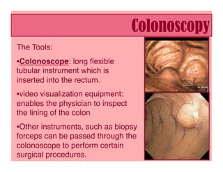 Colonoscopy
The Tools:
• Colonoscope: long ﬂexible
tubular instrument which is
inserted into the rectum. 
• video visualization equipment:
enables the physician to inspect
the lining of the colon 
• Other instruments, such as biopsy
forceps can be passed through the
colonoscope to perform certain
surgical procedures.
 