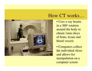 How CT works…	

   •  Uses x-ray beams
   in a 360o rotation
   around the body to
   obtain 1mm slices
   of bone, tissue and
   blood vessels	

   •  Computers collect
   the individual slices
   and allows for
   manipulation on a
   computer screen	

 