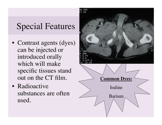 Special Features	

•  Contrast agents (dyes)
   can be injected or
   introduced orally
   which will make
   speciﬁc tissues stand
   out on the CT ﬁlm.	

    Common Dyes:
                                       	

•  Radioactive                  Iodine
                                     	

   substances are often        Barium	

   used.	

 