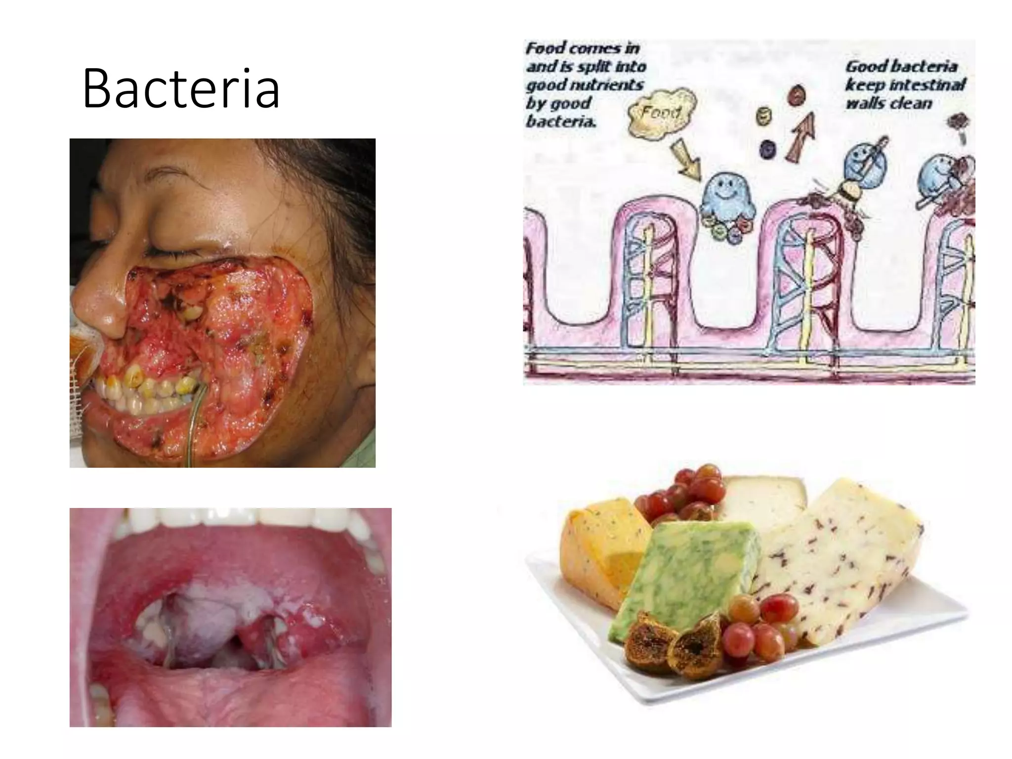 Bacteria
 