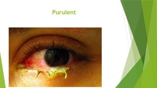 Purulent
 