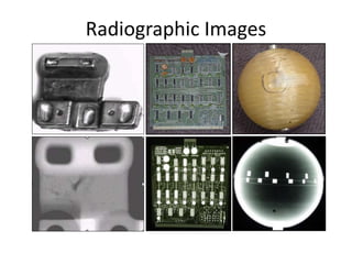 Radiographic Images
 