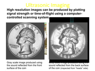 Ultrasonic Imaging
Gray scale image produced using
the sound reflected from the front
surface of the coin
Gray scale image produced using the
sound reflected from the back surface
of the coin (inspected from “heads” side)
High resolution images can be produced by plotting
signal strength or time-of-flight using a computer-
controlled scanning system.
 