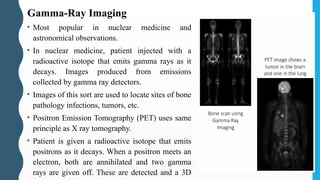 • Most popular in nuclear medicine and
astronomical observations.
• In nuclear medicine, patient injected with a
radioactive isotope that emits gamma rays as it
decays. Images produced from emissions
collected by gamma ray detectors.
• Images of this sort are used to locate sites of bone
pathology infections, tumors, etc.
• Positron Emission Tomography (PET) uses same
principle as X ray tomography.
• Patient is given a radioactive isotope that emits
positrons as it decays. When a positron meets an
electron, both are annihilated and two gamma
rays are given off. These are detected and a 3D
Gamma-Ray Imaging
 