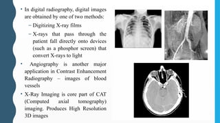• In digital radiography, digital images
are obtained by one of two methods:
– Digitizing X-ray films
– X-rays that pass through the
patient fall directly onto devices
(such as a phosphor screen) that
convert X-rays to light
• Angiography is another major
application in Contrast Enhancement
Radiography – images of blood
vessels
• X-Ray Imaging is core part of CAT
(Computed axial tomography)
imaging. Produces High Resolution
3D images
 