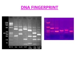 DNA FINGERPRINT

 