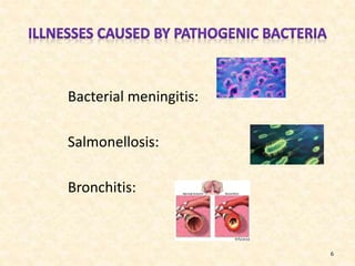 Bacterial meningitis:

Salmonellosis:
Bronchitis:

6

 