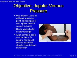 Chapter 19: Heart and Neck Vessels


                  Objective: Jugular Venous
                          Pressure
                   • Use angle of Louis as
                     arbitrary reference
                     point, and compare it
                     with highest level of
                     venous pulsation
                   • Hold a vertical ruler
                     on sternal angle
                   • Align a straight edge
                     on ruler like a T-
                     square, and adjust
                     level of horizontal
                     straight edge to level
                     of pulsation


                   Elsevier items and derived items © 2012, 2008, 2004, 2000, 1996, 1992 by Saunders, an imprint of Elsevier Inc.   Slide 23-92
 