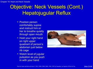 Chapter 19: Heart and Neck Vessels


          Objective: Neck Vessels (Cont.)
               Hepatojugular Reflux
                   • Position person
                     comfortably supine
                     and instruct him or
                     her to breathe quietly
                     through open mouth
                   • Hold your right hand
                     on right upper
                     quadrant of person’s
                     abdomen just below
                     rib cage
                   • Watch level of jugular
                     pulsation as you push
                     in with your hand

                   Elsevier items and derived items © 2012, 2008, 2004, 2000, 1996, 1992 by Saunders, an imprint of Elsevier Inc.   Slide 23-96
 