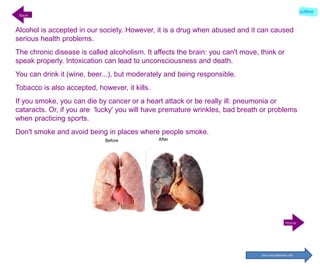 AfterBefore
Back
Home
outline
Alcohol is accepted in our society. However, it is a drug when abused and it can caused
serious health problems.
The chronic disease is called alcoholism. It affects the brain: you can't move, think or
speak properly. Intoxication can lead to unconsciousness and death.
You can drink it (wine, beer...), but moderately and being responsible.
Tobacco is also accepted, however, it kills.
If you smoke, you can die by cancer or a heart attack or be really ill: pneumonia or
cataracts. Or, if you are 'lucky' you will have premature wrinkles, bad breath or problems
when practicing sports.
Don't smoke and avoid being in places where people smoke.
Sites and additional info
 