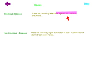 Causes
Infectious diseases
Non-infectious diseases
These are caused by infectious agents: flu, hepatitis,
pneumonia...
These are caused by organ malfunction or poor nutrition: lack of
vitamin D can cause rickets.
Back outline
 