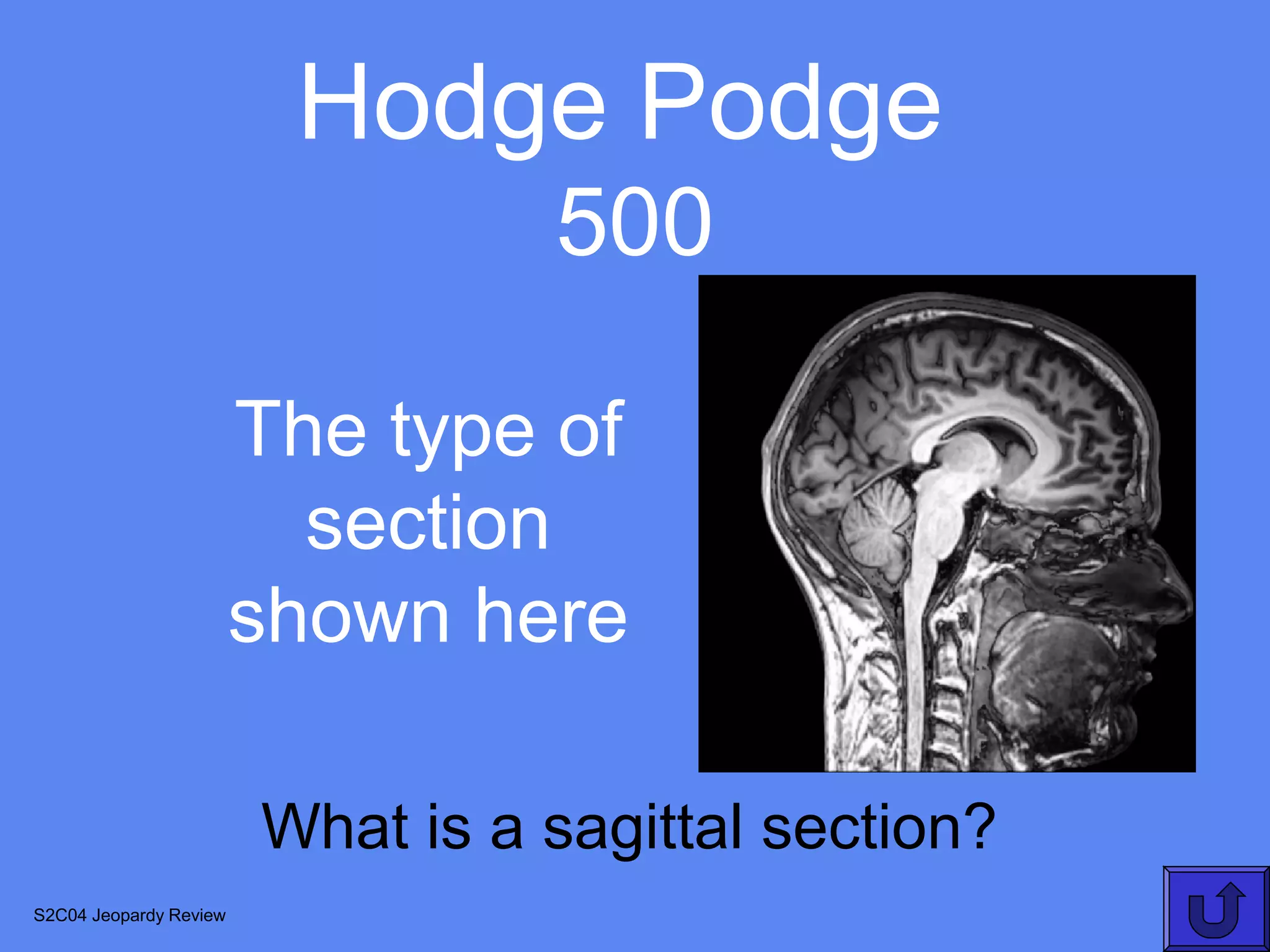 Hodge Podge
                                  500

                        The type of
                          section
                        shown here

                        What is a sagittal section?
S2C04 Jeopardy Review
 
