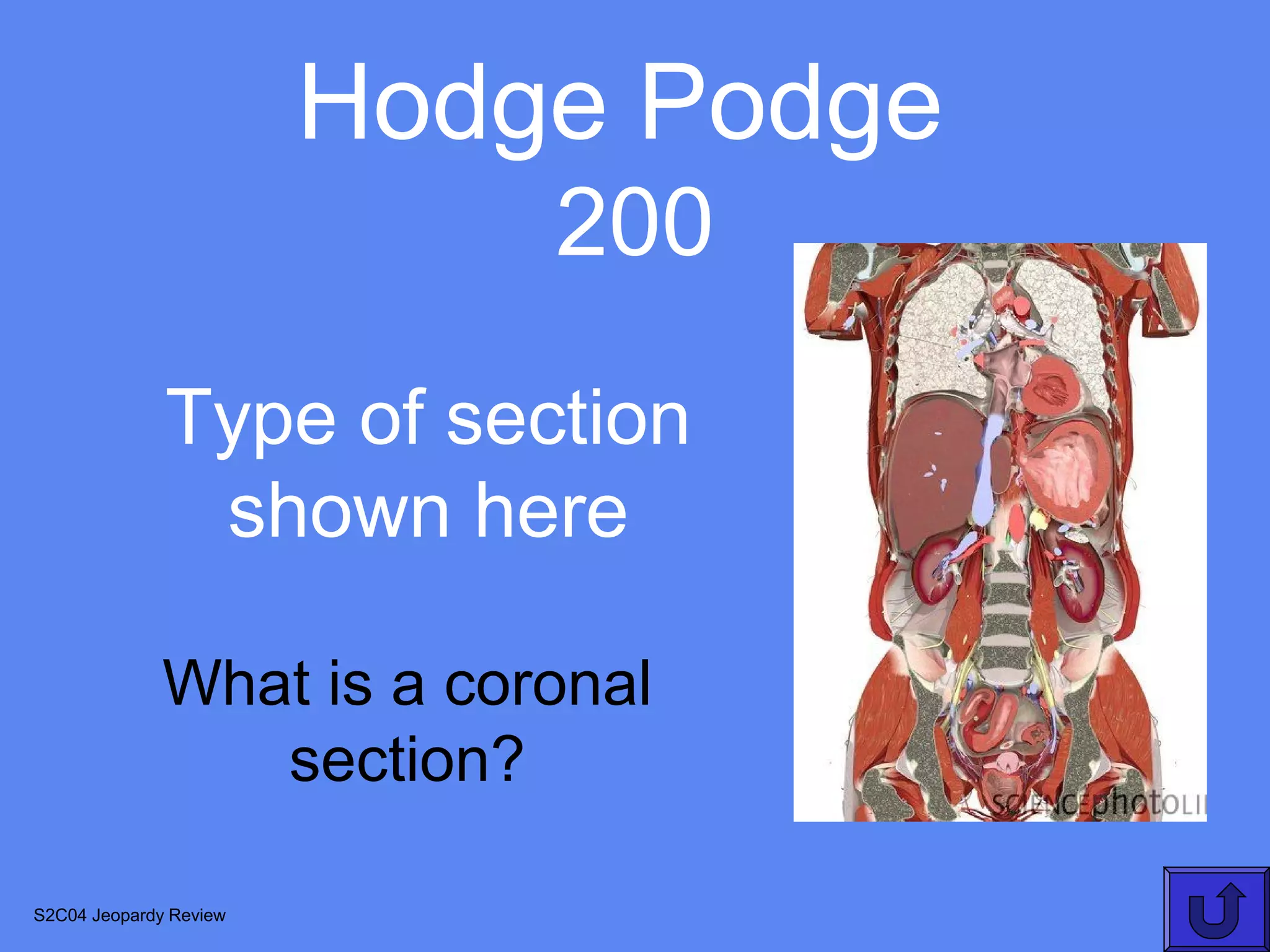Hodge Podge
                            200
              Type of section
               shown here

              What is a coronal
                 section?

S2C04 Jeopardy Review
 