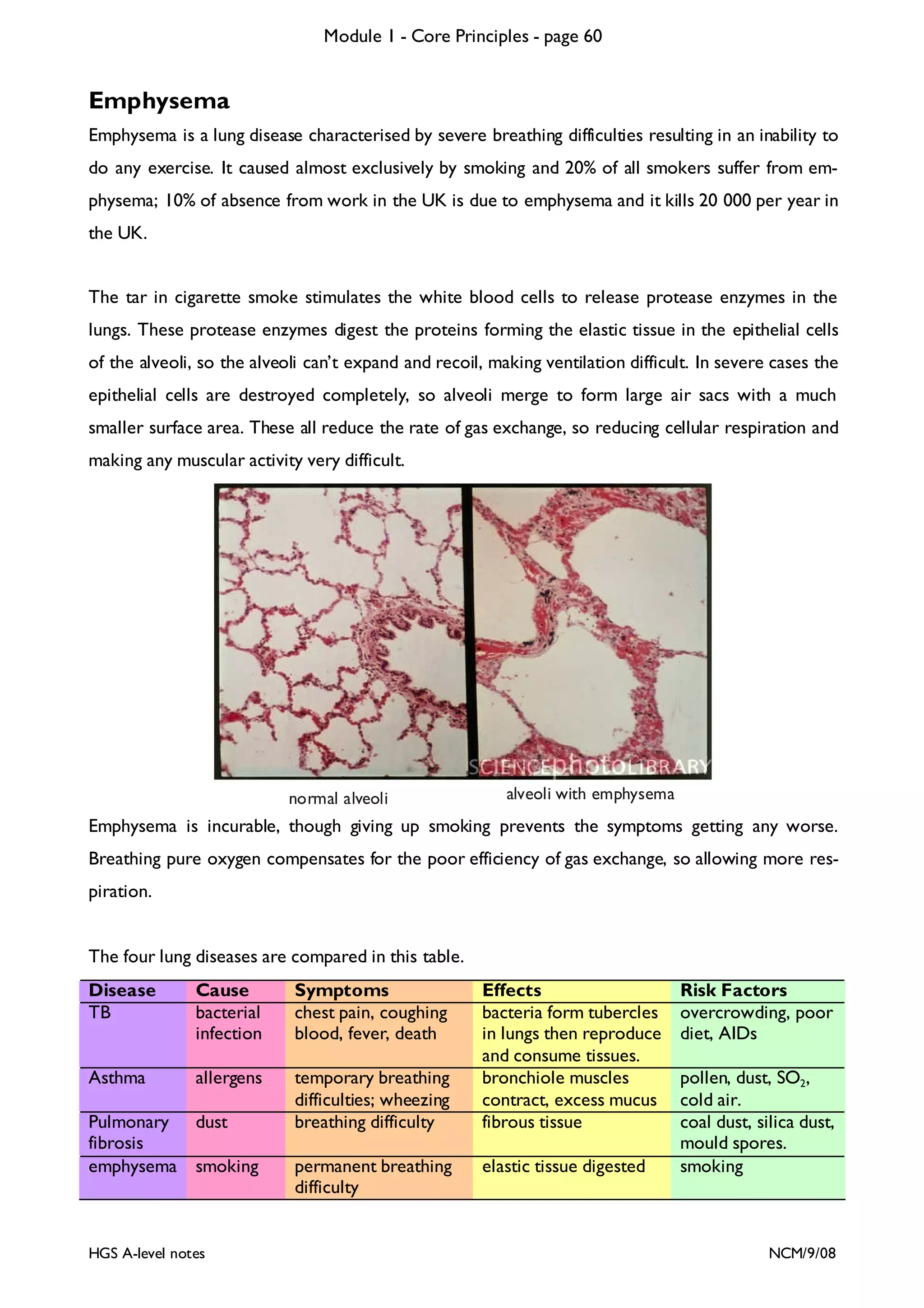 Module 1 - Core Principles - page 60

Emphysema
Emphysema is a lung disease characterised by severe breathing difficulties resulting in an inability to
do any exercise. It caused almost exclusively by smoking and 20% of all smokers suffer from emphysema; 10% of absence from work in the UK is due to emphysema and it kills 20 000 per year in
the UK.
The tar in cigarette smoke stimulates the white blood cells to release protease enzymes in the
lungs. These protease enzymes digest the proteins forming the elastic tissue in the epithelial cells
of the alveoli, so the alveoli can’t expand and recoil, making ventilation difficult. In severe cases the
epithelial cells are destroyed completely, so alveoli merge to form large air sacs with a much
smaller surface area. These all reduce the rate of gas exchange, so reducing cellular respiration and
making any muscular activity very difficult.

normal alveoli

alveoli with emphysema

Emphysema is incurable, though giving up smoking prevents the symptoms getting any worse.
Breathing pure oxygen compensates for the poor efficiency of gas exchange, so allowing more respiration.
The four lung diseases are compared in this table.
Disease
TB

Cause
bacterial
infection

Symptoms
chest pain, coughing
blood, fever, death

Asthma

allergens

temporary breathing
difficulties; wheezing
breathing difficulty

Pulmonary dust
fibrosis
emphysema smoking

HGS A-level notes

permanent breathing
difficulty

Effects
bacteria form tubercles
in lungs then reproduce
and consume tissues.
bronchiole muscles
contract, excess mucus
fibrous tissue

elastic tissue digested

Risk Factors
overcrowding, poor
diet, AIDs

pollen, dust, SO2,
cold air.
coal dust, silica dust,
mould spores.
smoking

NCM/9/08

 