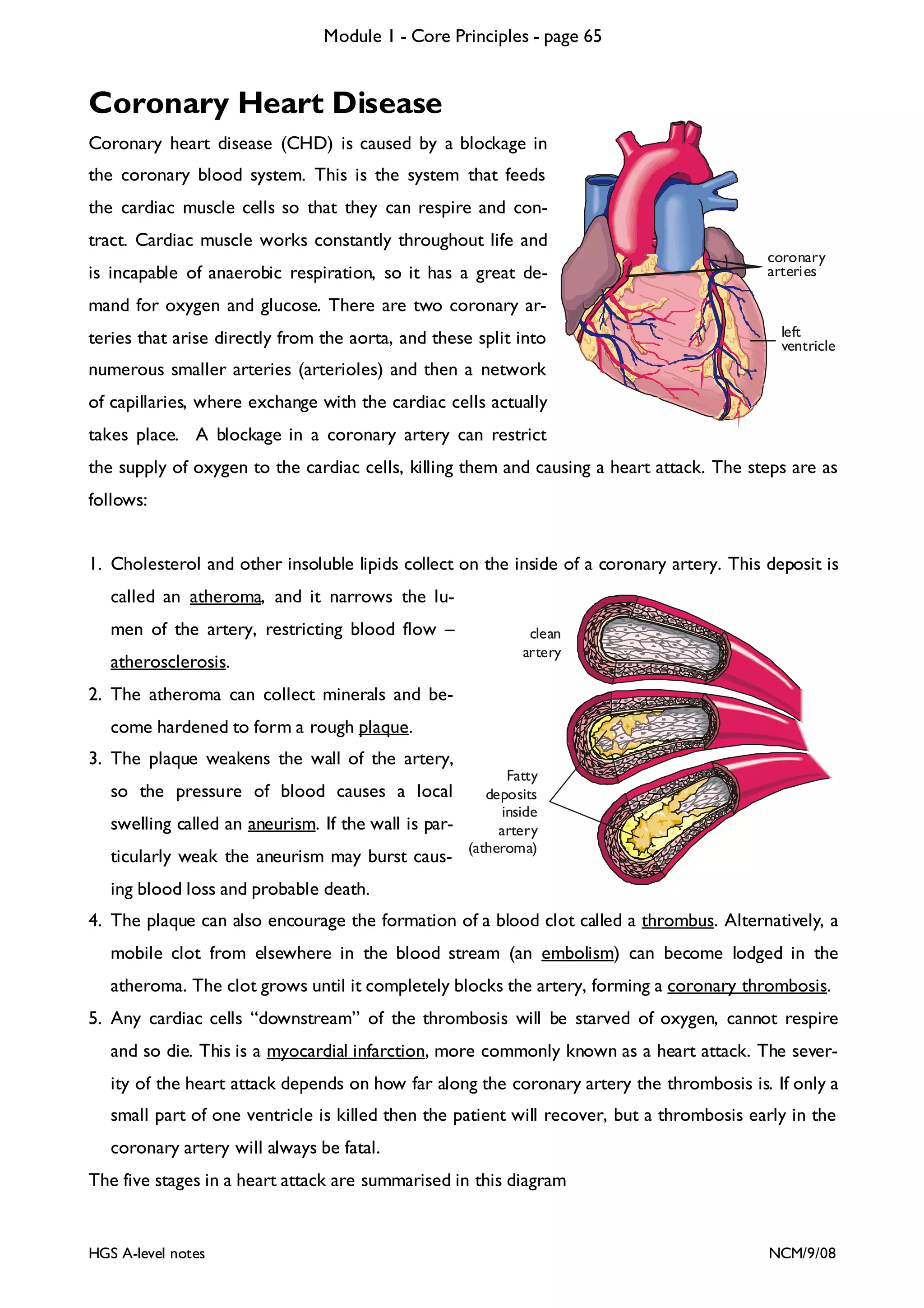 Module 1 - Core Principles - page 65

Coronary Heart Disease
Coronary heart disease (CHD) is caused by a blockage in
the coronary blood system. This is the system that feeds
the cardiac muscle cells so that they can respire and contract. Cardiac muscle works constantly throughout life and
is incapable of anaerobic respiration, so it has a great de-

coronary
arteries

mand for oxygen and glucose. There are two coronary arteries that arise directly from the aorta, and these split into

left
ventricle

numerous smaller arteries (arterioles) and then a network
of capillaries, where exchange with the cardiac cells actually
takes place. A blockage in a coronary artery can restrict
the supply of oxygen to the cardiac cells, killing them and causing a heart attack. The steps are as
follows:
1. Cholesterol and other insoluble lipids collect on the inside of a coronary artery. This deposit is
called an atheroma, and it narrows the lumen of the artery, restricting blood flow –
atherosclerosis.

clean
artery

2. The atheroma can collect minerals and become hardened to form a rough plaque.
3. The plaque weakens the wall of the artery,
so the pressure of blood causes a local
swelling called an aneurism. If the wall is particularly weak the aneurism may burst caus-

Fatty
deposits
inside
artery
(atheroma)

ing blood loss and probable death.
4. The plaque can also encourage the formation of a blood clot called a thrombus. Alternatively, a
mobile clot from elsewhere in the blood stream (an embolism) can become lodged in the
atheroma. The clot grows until it completely blocks the artery, forming a coronary thrombosis.
5. Any cardiac cells “downstream” of the thrombosis will be starved of oxygen, cannot respire
and so die. This is a myocardial infarction, more commonly known as a heart attack. The severity of the heart attack depends on how far along the coronary artery the thrombosis is. If only a
small part of one ventricle is killed then the patient will recover, but a thrombosis early in the
coronary artery will always be fatal.
The five stages in a heart attack are summarised in this diagram

HGS A-level notes

NCM/9/08

 