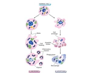 Basic Principles of Cell Injury and Adaptation | PPTX