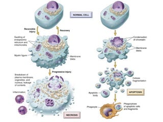Basic Principles of Cell Injury and Adaptation | PPTX