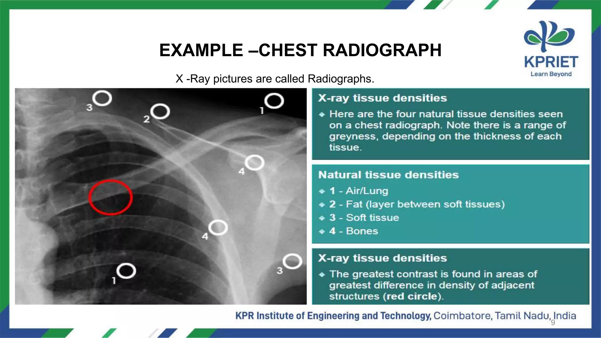 Unit 1 ppt notes /BM8702 /RADIOLOGICAL EQUIPMENTS | PPT