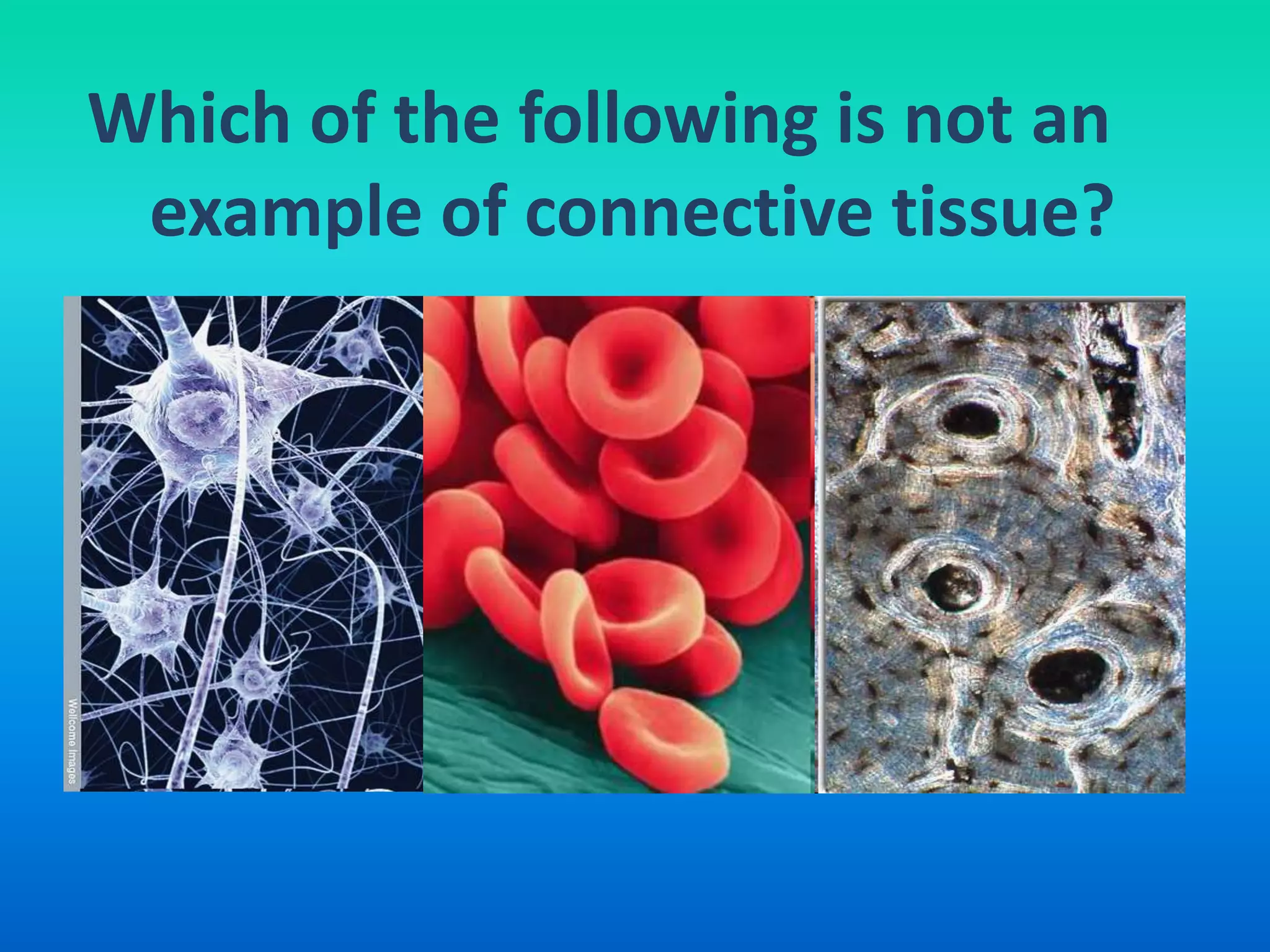 Which of the following is not an
 example of connective tissue?
 