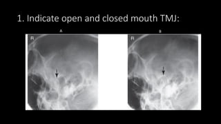 Comprehensive Radiographic Techniques for Mandible, TMJ, and Mastoid ...