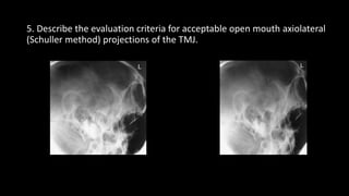 Comprehensive Radiographic Techniques for Mandible, TMJ, and Mastoid ...