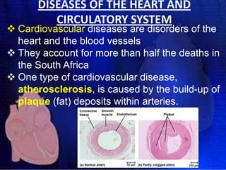 DISEASES OF THE HEART AND
CIRCULATORY SYSTEM

 Cardiovascular diseases are disorders of the
heart and the blood vessels
 They account for more than half the deaths in
the South Africa
 One type of cardiovascular disease,
atherosclerosis, is caused by the build-up of
plaque (fat) deposits within arteries.

 
