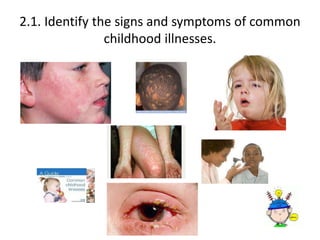 2.1. Identify the signs and symptoms of common 
childhood illnesses. 
 