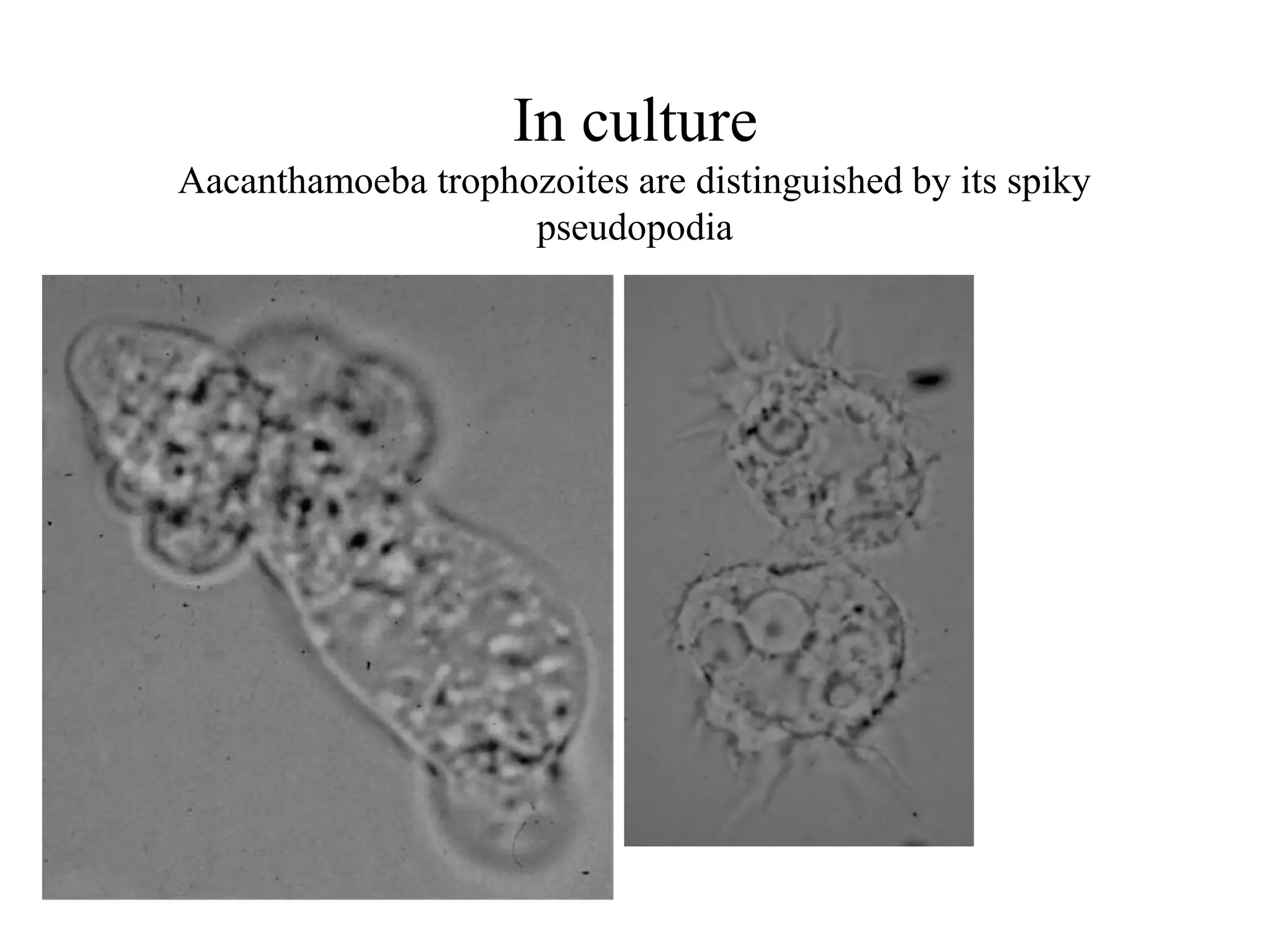 Unit 2 2 free living amoeba ppt