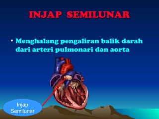 Injap UNIT 2.4 dan 2.5 (Sistem Kardiorespiratori - y.ppt