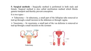 Tubesctomy Methods Comprehensive Overview of Preventive Healthcare: Demography, Family ...